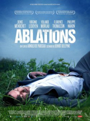 Ablations streaming